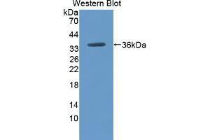 anti-Carboxypeptidase N Subunit 2 (CPN2) (AA 249-540) antibody