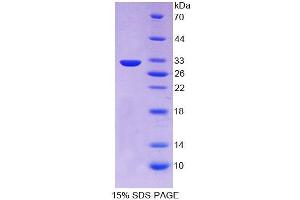 Image no. 1 for Proprotein Convertase Subtilisin/kexin Type 1 (PCSK1) (AA 500-738) protein (His tag) (ABIN6237036)