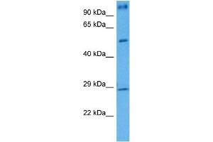 Image no. 5 for anti-Brain-Derived Neurotrophic Factor (BDNF) (Middle Region) antibody (ABIN2777093)