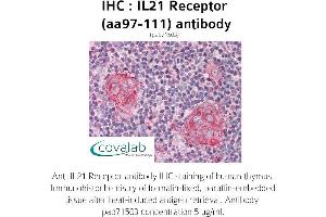 Image no. 1 for anti-Interleukin 21 Receptor (IL21R) (AA 97-111) antibody (ABIN1735895)