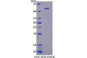 Image no. 1 for CD58 (CD58) (AA 1-214) protein (GST tag,His tag) (ABIN6236705)