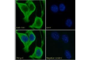 Image no. 1 for anti-Sonic Hedgehog (SHH) (C-Term) antibody (ABIN6391361)