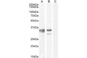 Image no. 2 for anti-Heterogeneous Nuclear Ribonucleoprotein A2/B1 (HNRNPA2B1) (Internal Region) antibody (ABIN1781995)