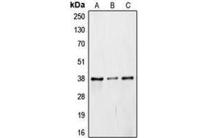 Image no. 2 for anti-COP9 Constitutive Photomorphogenic Homolog Subunit 5 (Arabidopsis) (COPS5) (Center) antibody (ABIN2706422)