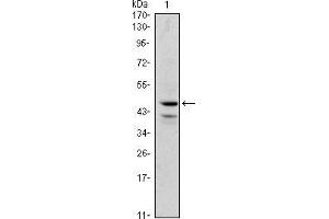 Image no. 1 for anti-GATA Binding Protein 1 (Globin Transcription Factor 1) (GATA1) antibody (ABIN969165)