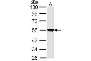 Image no. 3 for anti-Tripartite Motif Containing 21 (TRIM21) (Center) antibody (ABIN2856919)