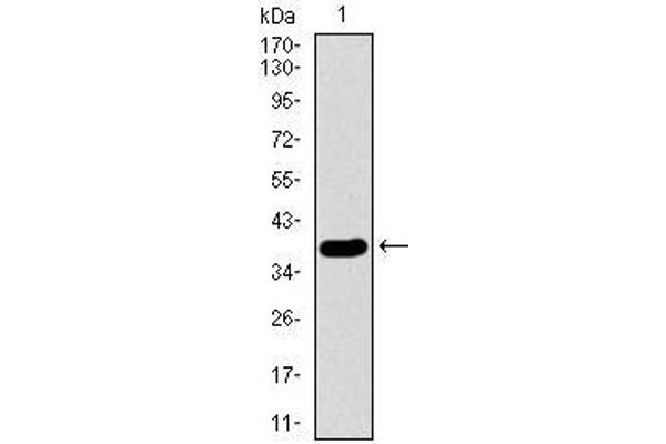 anti-Surfactant Protein C (SFTPC) (AA 60-180) antibody