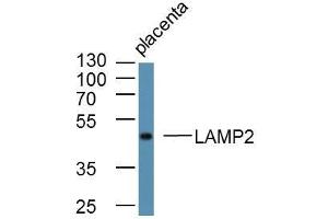 Image no. 4 for anti-Lysosomal-Associated Membrane Protein 2 (LAMP2) (AA 305-355) antibody (ABIN680198)