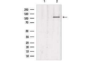 Image no. 3 for anti-Ubiquitin-Like Modifier Activating Enzyme 7 (UBA7) antibody (ABIN6265841)