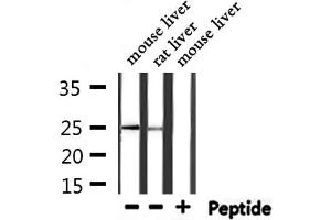 Image no. 4 for anti-Ferritin, Light Polypeptide (FTL) antibody (ABIN6261826)
