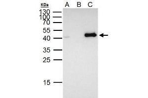 IP Image FOXE1 antibody immunoprecipitates FOXE1 protein in IP experiments.