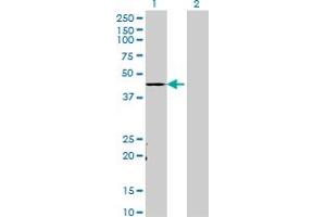 anti-Transcriptional Adaptor 3 (TADA3) (AA 1-432) antibody
