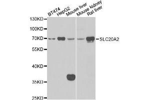 Image no. 2 for anti-Solute Carrier Family 20 (Phosphate Transporter), Member 2 (SLC20A2) antibody (ABIN6147880)