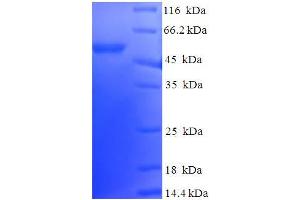 Image no. 1 for DnaJ (Hsp40) Homolog, Subfamily B, Member 2 (DNAJB2) (AA 2-324) protein (His-SUMO Tag) (ABIN5709407)