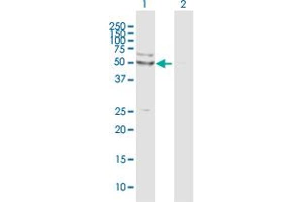 anti-Porcupine Homolog (PORCN) (AA 1-450) antibody