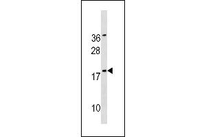 Image no. 1 for anti-Sorting Nexin 12 (SNX12) (AA 84-112) antibody (ABIN1881820)
