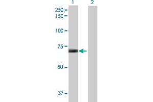 Image no. 1 for anti-Deltex Homolog 2 (DTX2) (AA 1-622) antibody (ABIN530231)