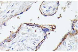 Immunohistochemistry of paraffin-embedded Human placenta using LTF Polyclonal Antibody at dilution of 1:100 (40x lens).