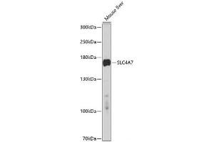 Western blot analysis of extracts of Mouse liver using SLC4A7 Polyclonal Antibody at dilution of 1:1000.