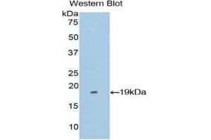 Image no. 1 for anti-Periostin (POSTN) (AA 500-630) antibody (ABIN1860279)