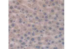 Image no. 2 for anti-T-Cell Leukemia/lymphoma 1A (TCL1A) (AA 6-112) antibody (ABIN1860691)
