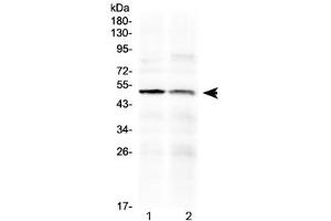 Image no. 1 for anti-HtrA Serine Peptidase 3 (HTRA3) (AA 330-362) antibody (ABIN5647345)