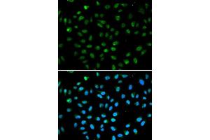 Immunofluorescence analysis of A549 cell using ATF6 antibody.