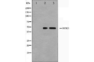 Image no. 1 for anti-Branched Chain Ketoacid Dehydrogenase Kinase (BCKDK) (N-Term) antibody (ABIN6260219)