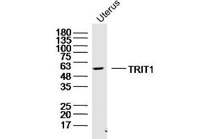anti-tRNA Isopentenyltransferase 1 (TRIT1) (AA 121-220) antibody