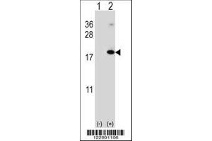 Image no. 2 for anti-Ring Finger Protein 5, E3 Ubiquitin Protein Ligase (RNF5) (AA 1-30) antibody (ABIN652548)