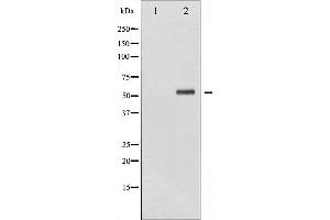 anti-Checkpoint Kinase 2 (CHEK2) (pSer516) antibody