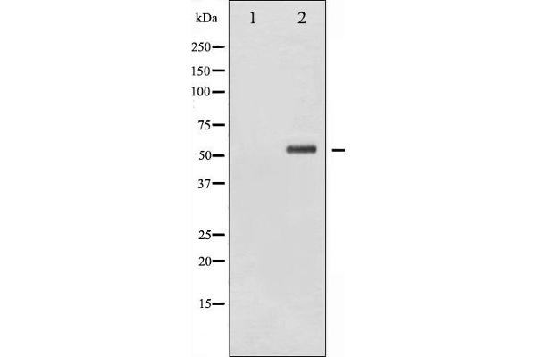 anti-Checkpoint Kinase 2 (CHEK2) (pSer516) antibody