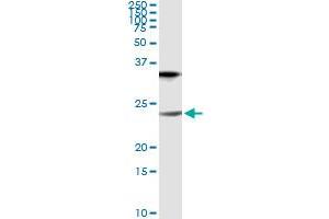 Image no. 5 for anti-Claudin 1 (CLDN1) (AA 1-211) antibody (ABIN563931)