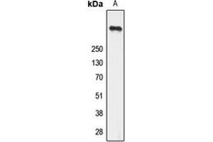 Image no. 3 for anti-Ryanodine Receptor 2 (Cardiac) (RYR2) (pSer2808) antibody (ABIN2707001)