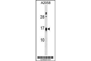 Image no. 1 for anti-Limb-Bud and Heart (LBH) (AA 26-53) antibody (ABIN1538189)