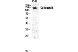 COL2A1 Antikörper  (AA 70-150)