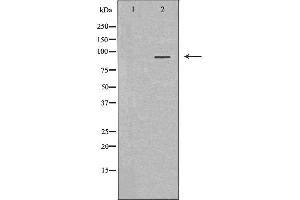Image no. 1 for anti-Mucosa Associated Lymphoid Tissue Lymphoma Translocation Gene 1 (MALT1) (Internal Region) antibody (ABIN6263086)