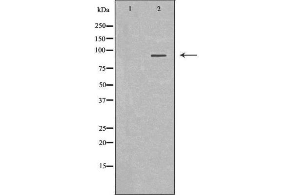 anti-Mucosa Associated Lymphoid Tissue Lymphoma Translocation Gene 1 (MALT1) (Internal Region) antibody
