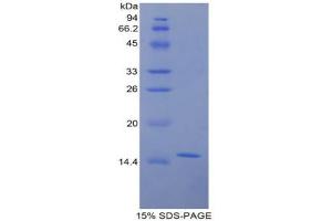Image no. 1 for Galactosylceramidase (GALC) protein (ABIN3009517)