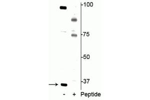 Image no. 1 for anti-DNA-Damage-Inducible Transcript 4 (DDIT4) (pThr23), (pThr25) antibody (ABIN6254086)