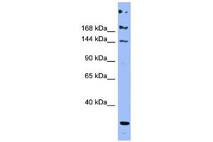 Image no. 3 for anti-Apolipoprotein B (APOB) (Middle Region) antibody (ABIN2776957)