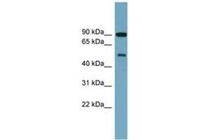 Image no. 1 for anti-Phosphatidylinositol 4-Kinase Type 2 beta (PI4K2B) (AA 143-192) antibody (ABIN6744142)