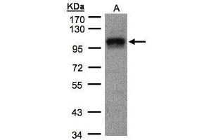 Image no. 2 for anti-Eukaryotic Translation Initiation Factor 4 gamma 2 (EIF4G2) (N-Term) antibody (ABIN2855137)