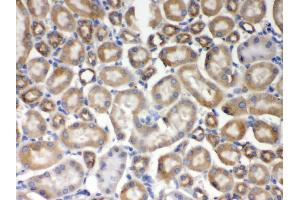 Image no. 3 for anti-Absent in Melanoma 2 (AIM2) (AA 14-215) antibody (ABIN3043780)