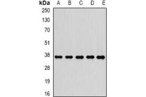 Image no. 1 for anti-Proteasome (Prosome, Macropain) 26S Subunit, Non-ATPase, 7 (PSMD7) antibody (ABIN2966953)