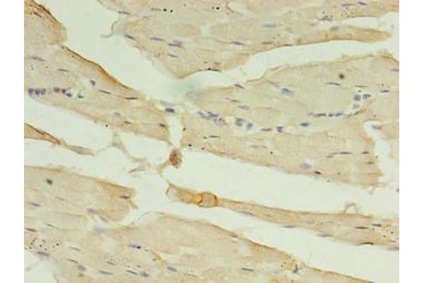 CA5B anticorps  (AA 34-314)