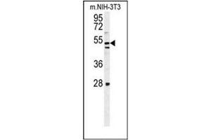 Image no. 3 for anti-MTOR associated protein, eak-7 homolog (MEAK7) (AA 433-464), (C-Term) antibody (ABIN953064)