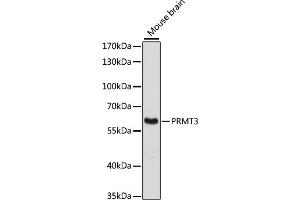 Western blot analysis of extracts of mouse brain, using PRMT3 antibody (ABIN6129634, ABIN6146229, ABIN6146230 and ABIN6216919) at 1:3000 dilution.