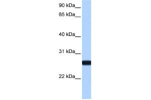 Image no. 1 for anti-Interleukin 13 Receptor, alpha 2 (IL13RA2) (N-Term) antibody (ABIN2785442)