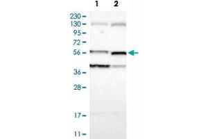 Image no. 3 for anti-Villin 1 (VIL1) antibody (ABIN5590731)